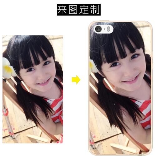 苏米克荣耀magic2手机壳图片